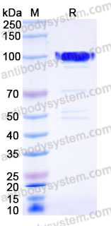 Recombinant Human PDILT Protein, C-His