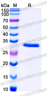 Recombinant Human DTD1 Protein, C-His