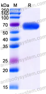 Recombinant Human SMPDL3A Protein, C-His