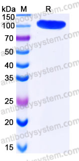 Recombinant Human CFHR4 Protein, C-His
