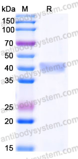 Recombinant Human ESAM Protein, C-His