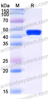 Recombinant Human RCN3 Protein, C-His