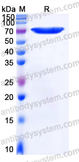 Recombinant Human ERO1A Protein, C-His