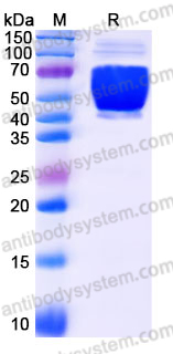 Recombinant Human TXNDC15 Protein, C-His