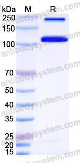 Recombinant Human COL21A1 Protein, C-His
