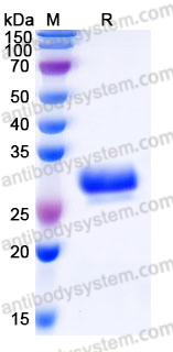 Recombinant Human CCDC134 Protein, C-His