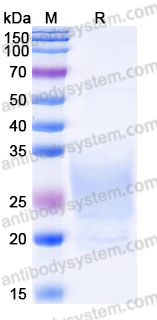 Recombinant Human BOC Protein, C-His