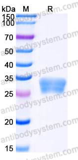 Recombinant Human NPDC1 Protein, C-His