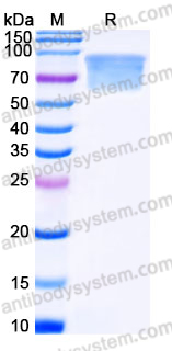 Recombinant Human THSD1 Protein, C-His