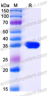 Recombinant Human CA10 Protein, C-His