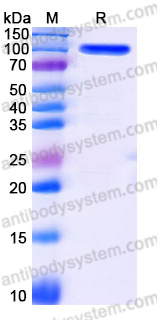 Recombinant Human SEMA4G Protein, C-His