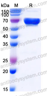 Recombinant Human MAN1B1 Protein, C-His