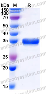 Recombinant Human KLK13 Protein, C-His