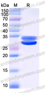 Recombinant Human EPDR1 Protein, C-His