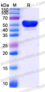 Recombinant Human MINPP1 Protein, C-His