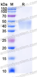 Recombinant Human NPTN Protein, C-His