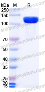 Recombinant Mouse CD203c/ENPP3 Protein, N-His