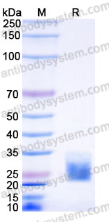 Recombinant Mouse CD160 Protein, C-His