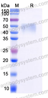 Recombinant Mouse CD25/IL2RA Protein, C-His
