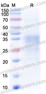Recombinant Mouse CD74 Protein, C-His