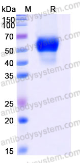 Recombinant Mouse CD126/IL6R/IL-6RA Protein, C-His