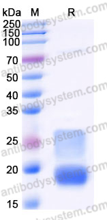 Recombinant Mouse CD7 Protein, C-His