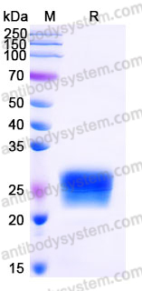 Recombinant Mouse CSF3/G-CSF Protein, C-His