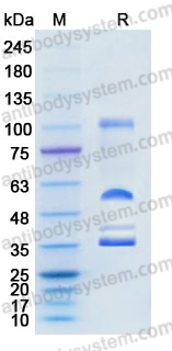 Recombinant Mouse HGF Protein, C-His