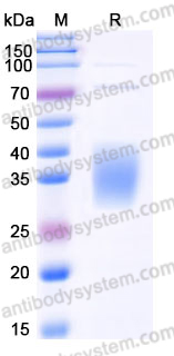 Recombinant Mouse IL9 Protein, C-His