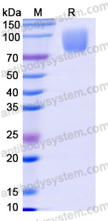 Recombinant Mouse CD140a/PDGFRA Protein, C-His