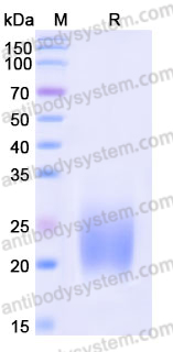 Recombinant Mouse CD152/CTLA4 Protein, C-His