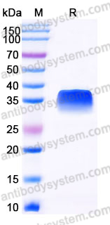 Recombinant Mouse CD326/EPCAM Protein, C-His