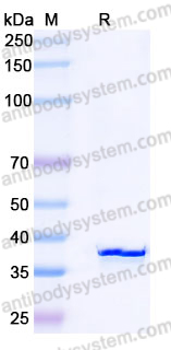 Recombinant Mouse CA4 Protein, C-His