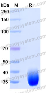 Recombinant Mouse CD124/IL4R/IL-4R&alpha; Protein, C-His
