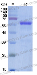 Recombinant Mouse GPC3/Glypican 3 Protein, C-His