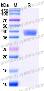 SDS-PAGE for Recombinant Mouse IL17RE Protein, C-His ?>