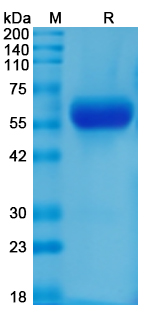 Recombinant Mouse IL1RL2/IL-36R Protein, C-His