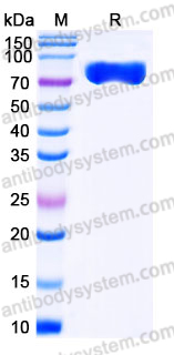 Recombinant Mouse CD229/LY9 Protein, C-His
