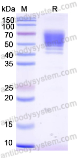 SDS-PAGE for Recombinant Dog IL4 Protein, C-Fc ?>
