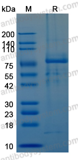 Recombinant Rat CD71/TFRC Protein, N-His