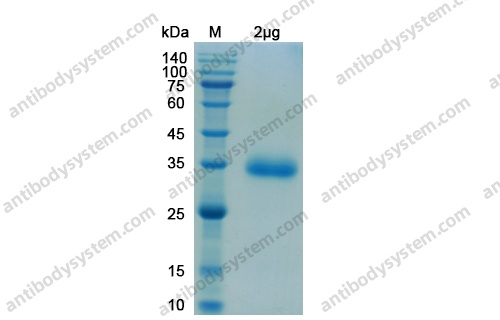 Recombinant SARS-CoV-2 RBD Protein, C-His