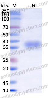 Recombinant SARS-CoV-2 RBD (Omicron/BA.2) Protein, C-His