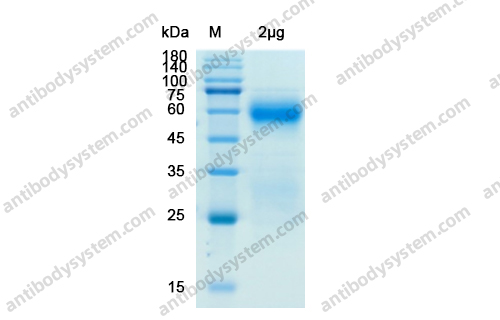 Recombinant SARS-CoV-2 N Protein, C-His