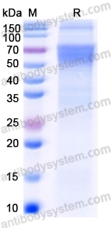 Recombinant Rabies virus/RABV G/Glycoprotein Protein, C-10*His