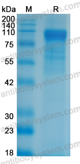 Recombinant REBOV GP1 Protein, C-His