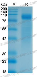 Recombinant SEBOV GP1 Protein, C-His