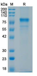 Recombinant Influenza A virus (H1N1) HA/Hemagglutinin Protein, C-His