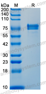 Recombinant Influenza A virus (H1N1) HA/Hemagglutinin Protein, C-His
