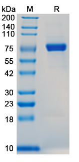 Recombinant Influenza A virus (H2N2) HA/Hemagglutinin Protein, C-His