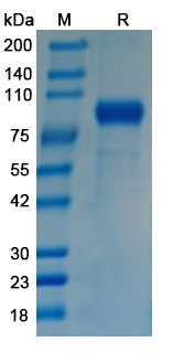 Recombinant Influenza A virus (H3N2) HA/Hemagglutinin Protein, C-His